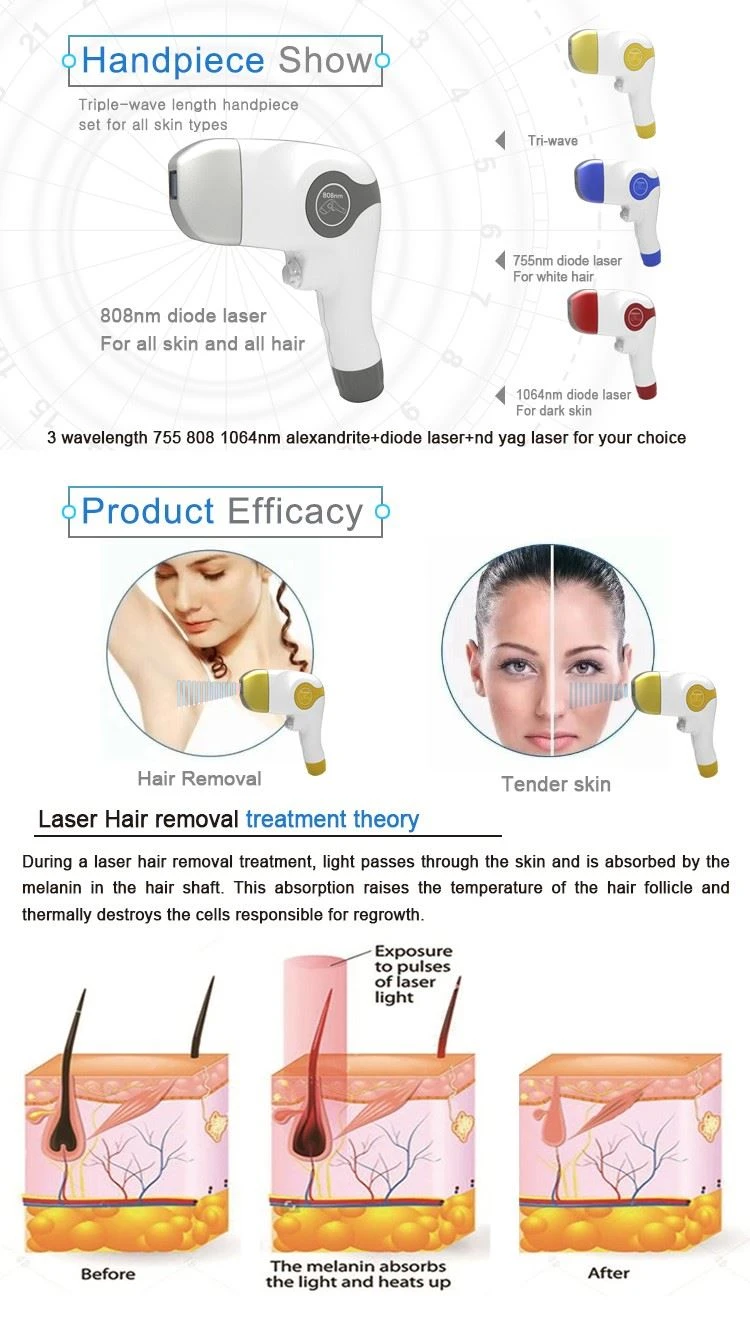 808 diode laser hair removal machine