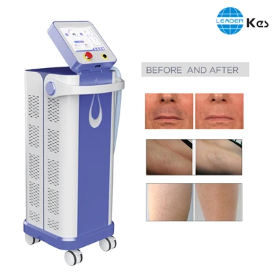 TUV Cool Ice 808nm Laser Diodo hårborttagningsmaskin